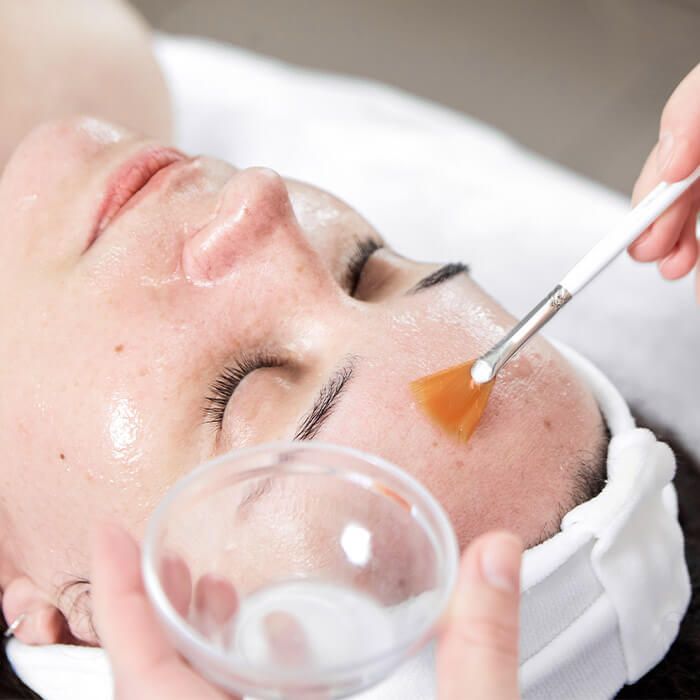 Peeling Químico